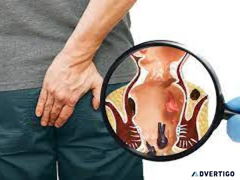 Piles treatment in ghaziabad
