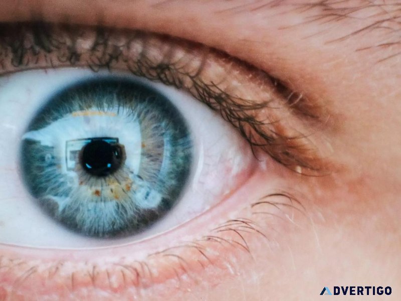 Who Needs Specialty Contact Lenses - Eye Clinic in Marysville WA