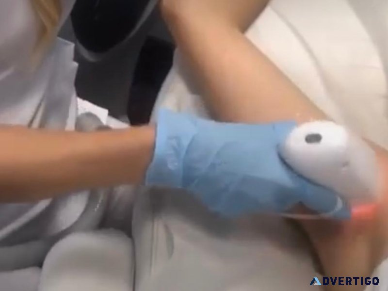 Electrolisis y Laser 1113