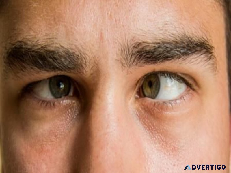 Best squint in eyes treatment in delhi