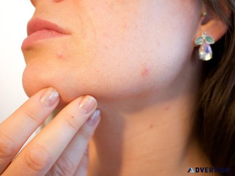 Rehydrate and Heal Your Skin. After Care and Daily Care