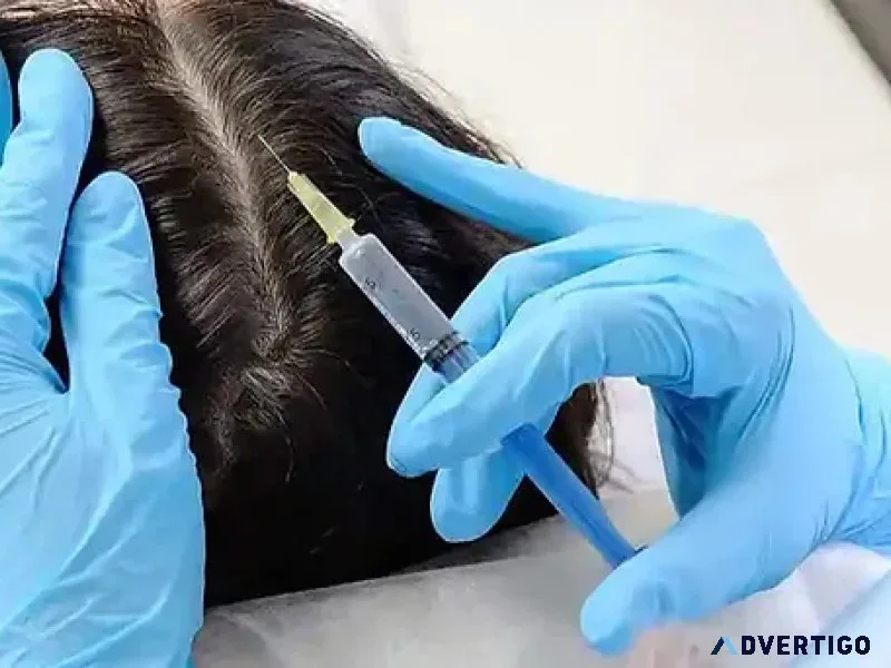 Hair transplant clinic in lucknow