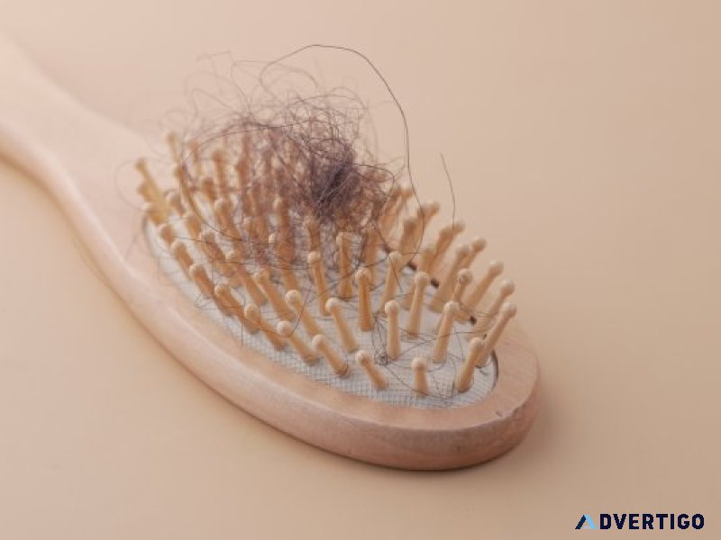 Hair fall treatment cost in hyderabad