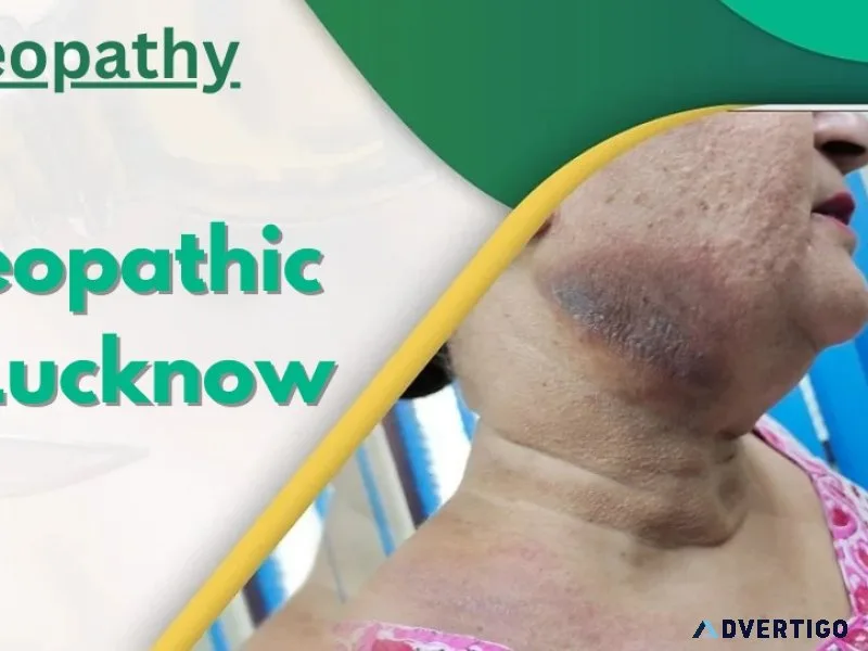 Best homeopathic doctor in lucknow