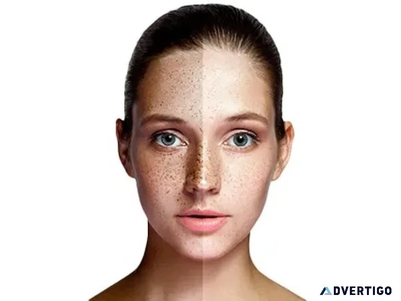 Dull skin treatment