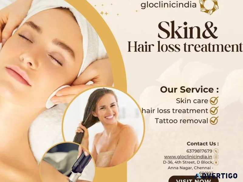 Prp for hair loss clinic in anna nagar