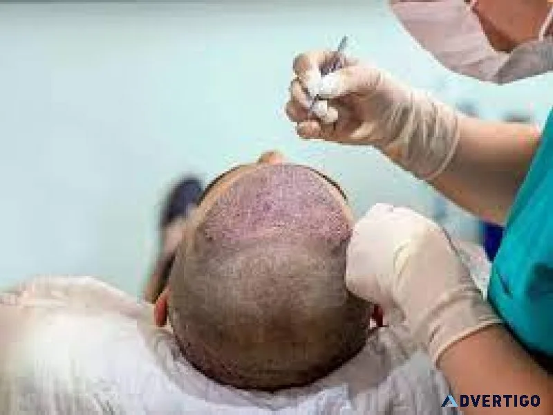 Best hair transplant in nashik | dr pranay thakur