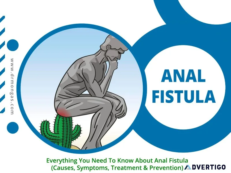 Best anal fistula treatment in nangloi - 8010931122