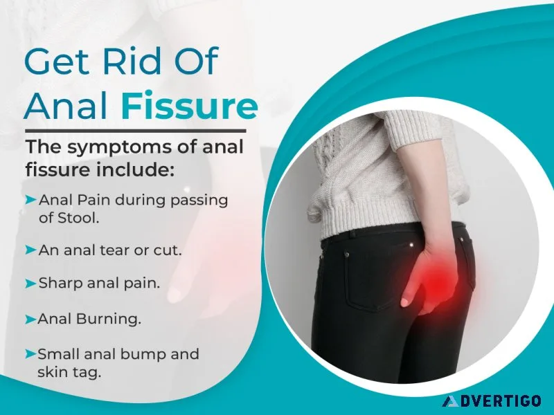 Anal fissure treatment in rohini - 8010931122