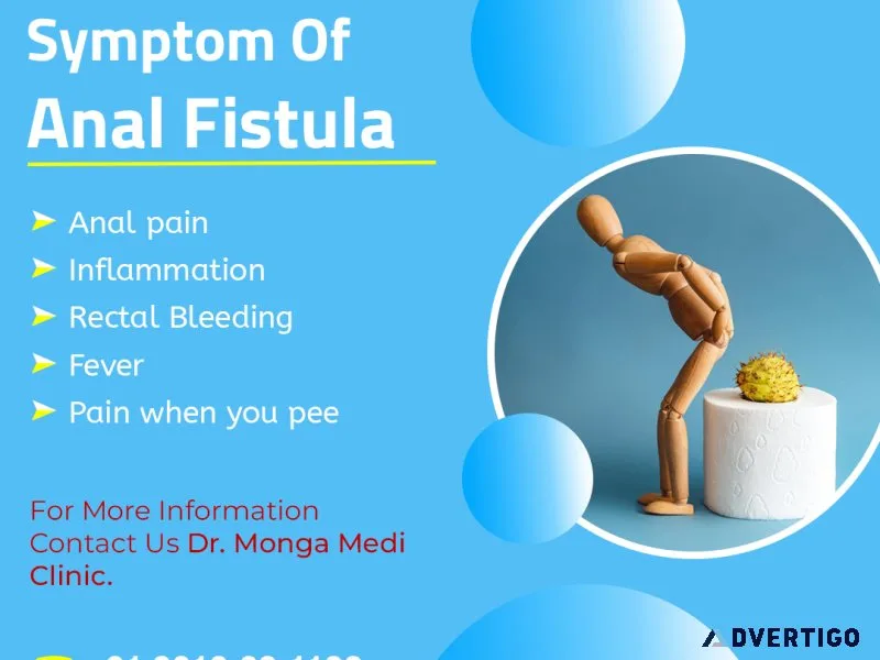 Best anal fistula treatment in tilak nagar call - 8010931122