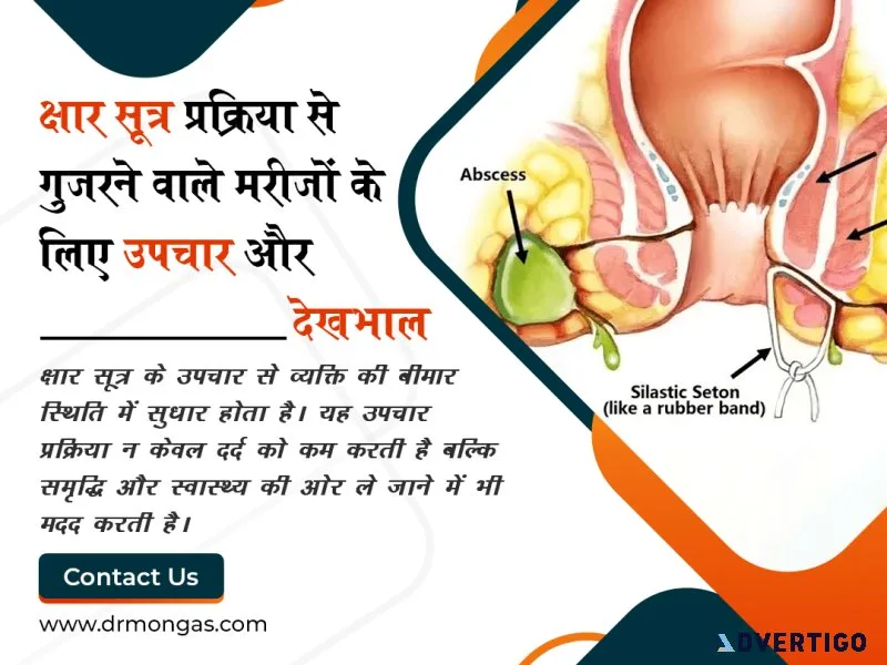 Best kshar sutra doctors in rohini 8010931122