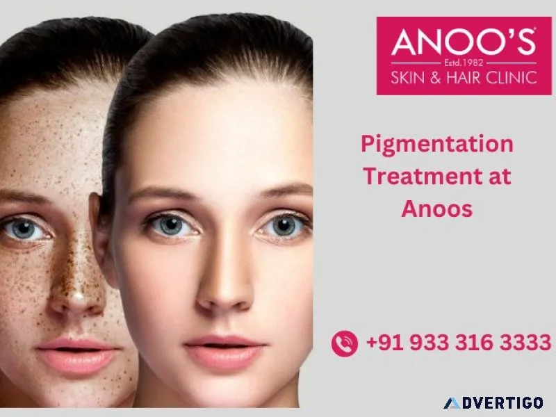 Advanced pigmentation treatment at anoos