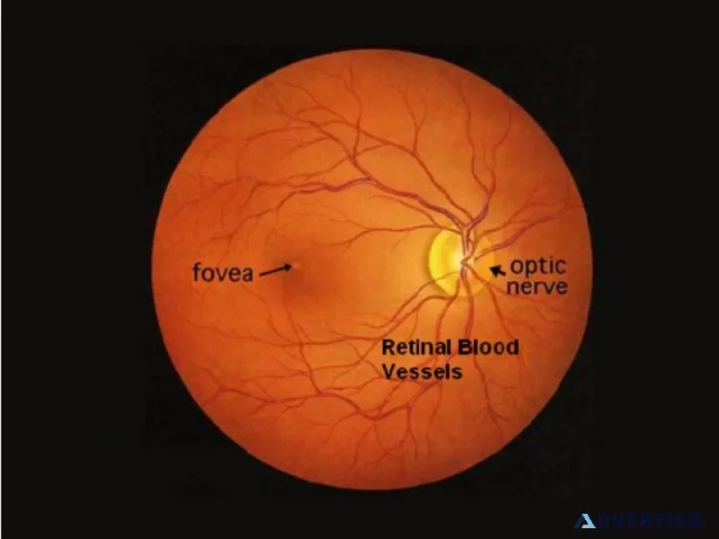 Retinal detachment surgery