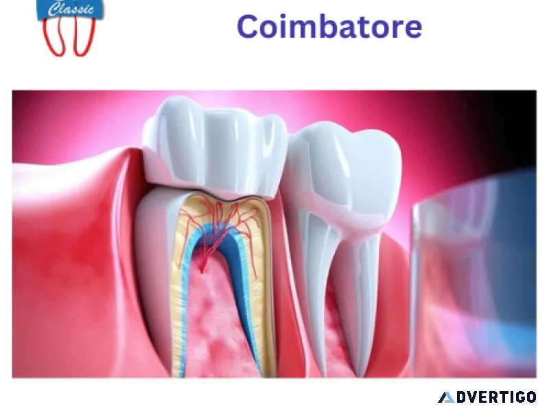 Root canal treatment in coimbatore | endodontist in coimbatore