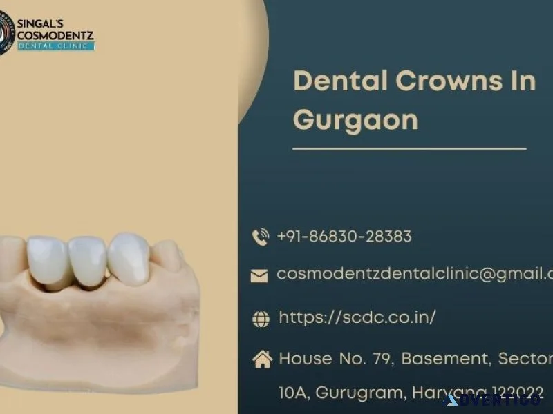 Revitalize your smile: expert dental crowns in gurgaon