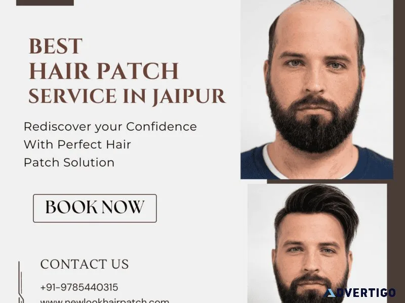 Hair patch service in jaipur