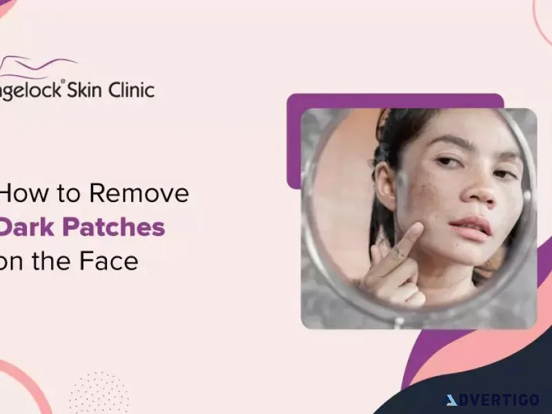 How to remove dark patches on the face - agelock skin clinic