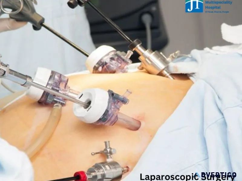 Laparoscopic surgery in army card