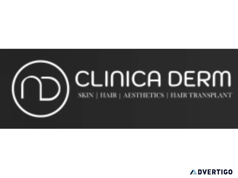 Best hair transplant clinic in hyderabad