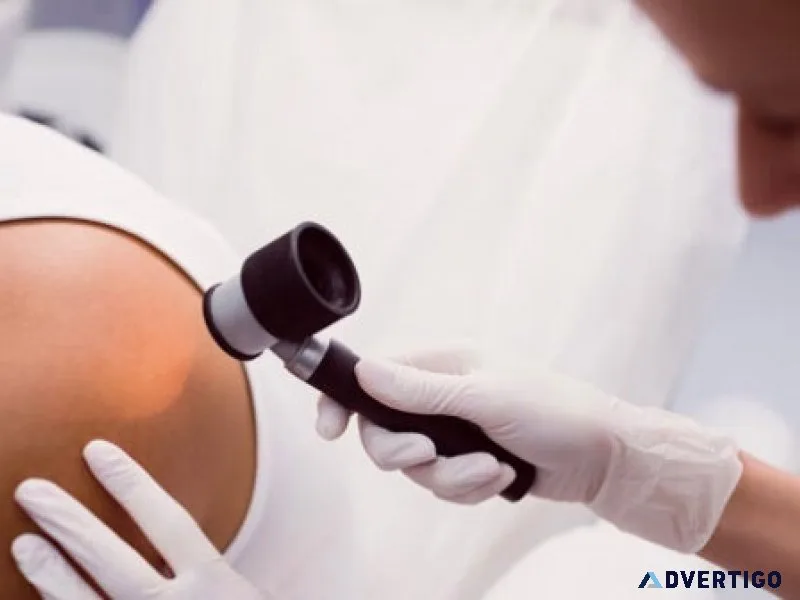 Orlando dermatology