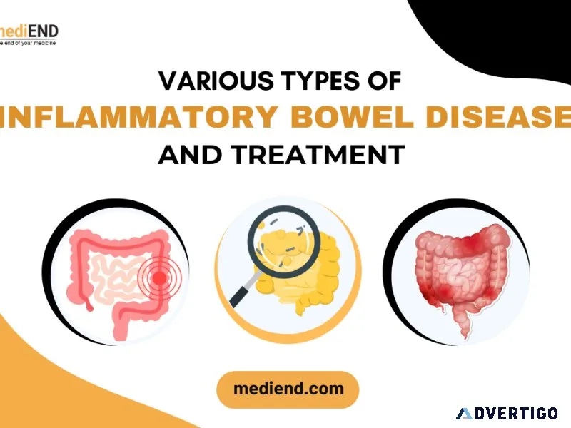 Various types of inflammatory bowel disease and treatment