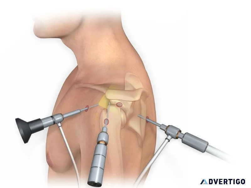 Total joint replacement surgery