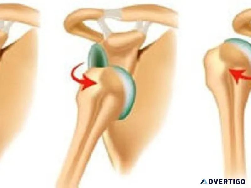 Shoulder dislocation treatment in delhi