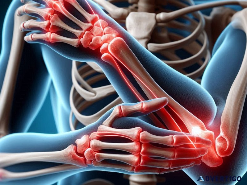 What are the symptoms of arthritis?