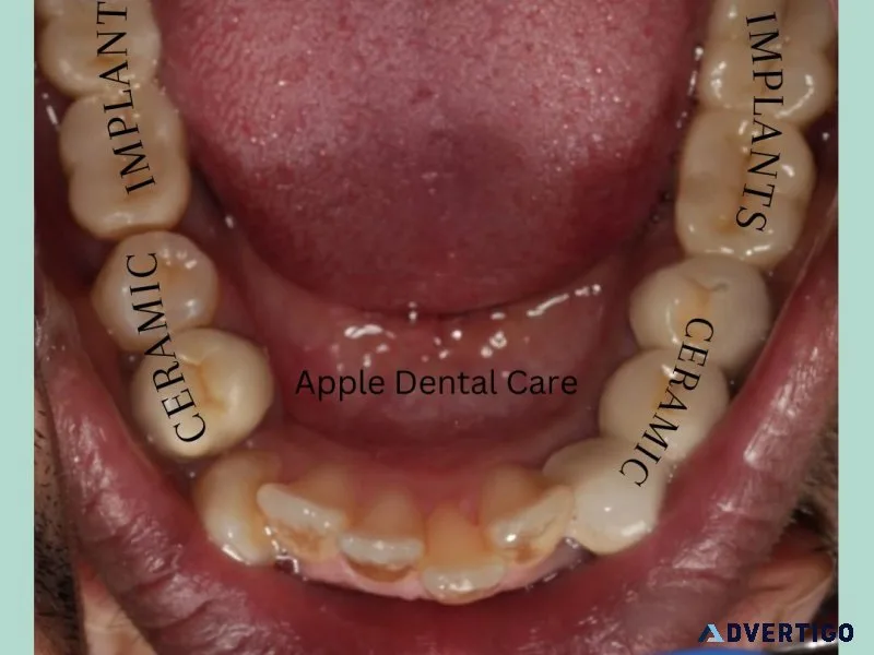 Best dental clinic in coimbatore