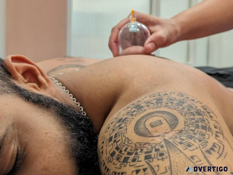 Cupping therapy