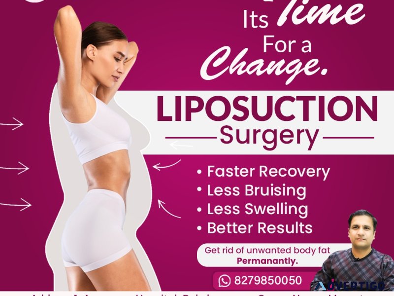 Best liposuction surgery in ncr