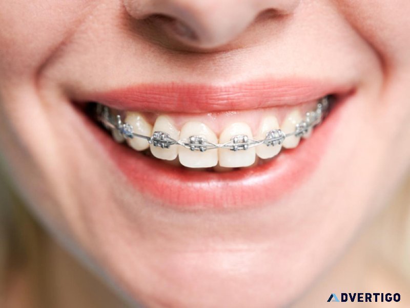 Dental implants in abu dhabi