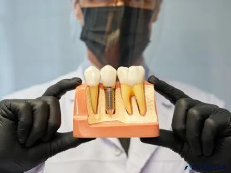 Dental crowns in al ain