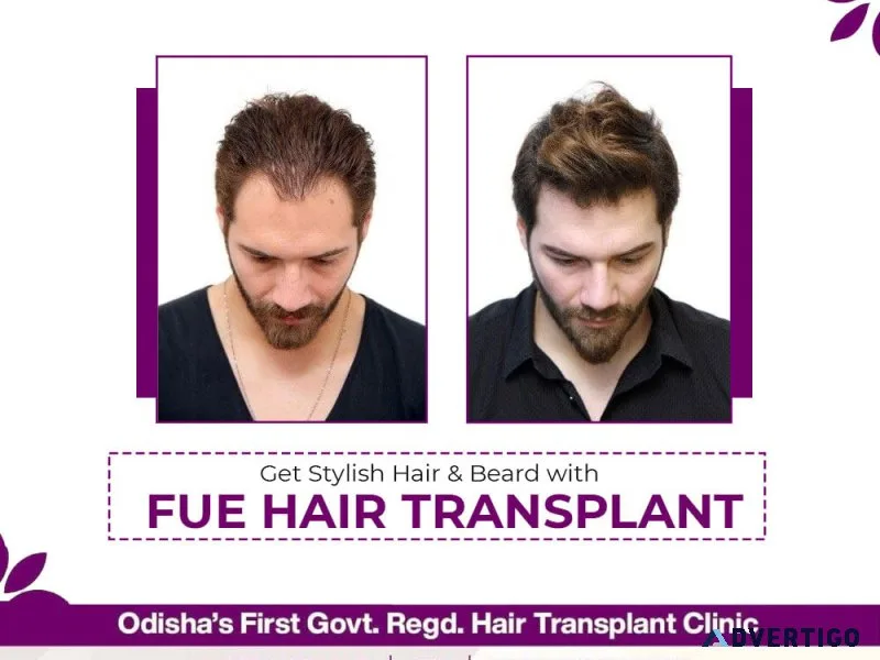 Best hair transplant clinic in bhubaneswar