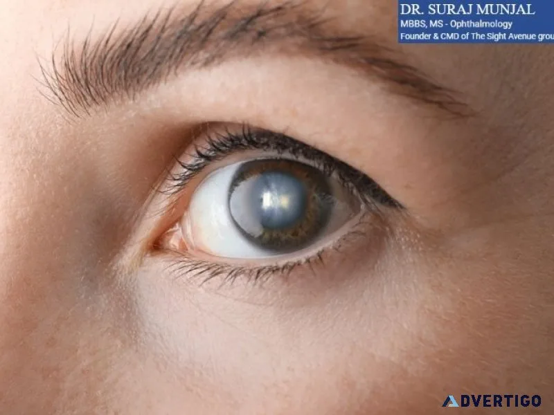 Cataract treatment in india