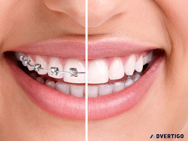 Cheapest dental clinic in abu dhabi