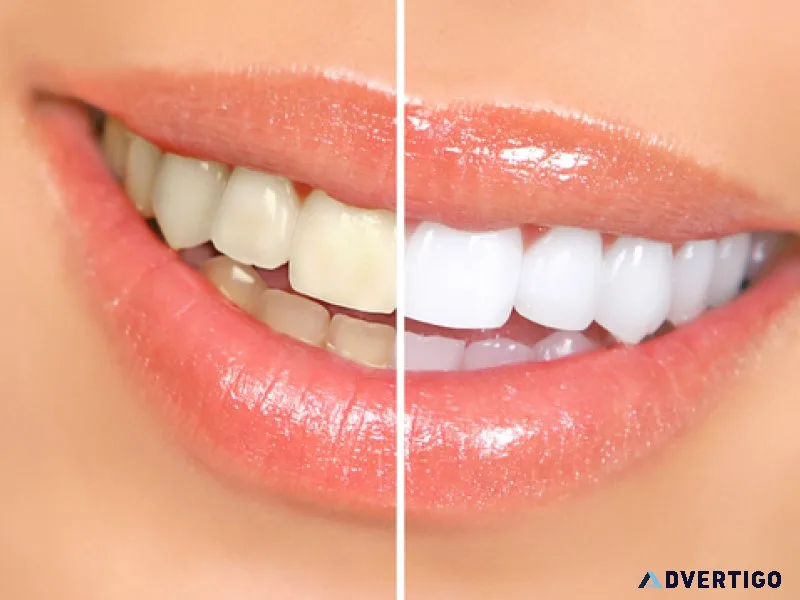 How to find the best dentist in jamnagar for your dental care