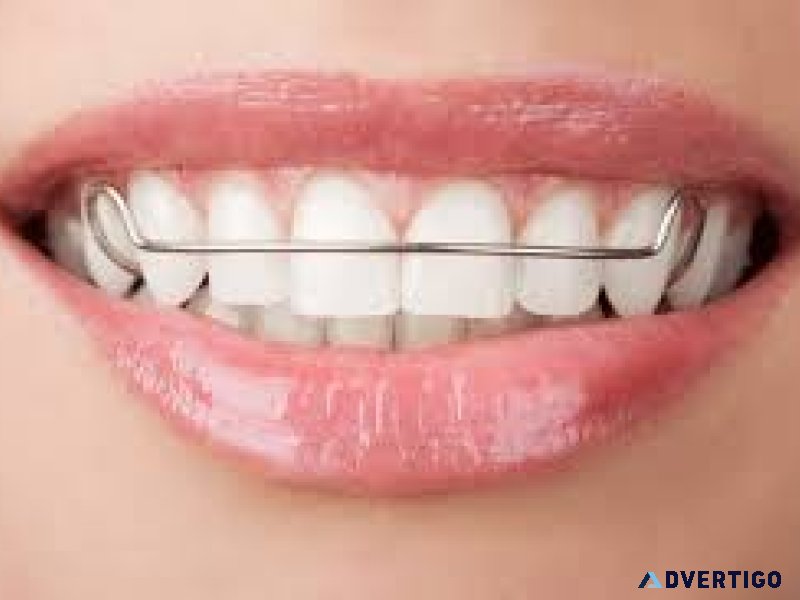 Retainers abudhabi