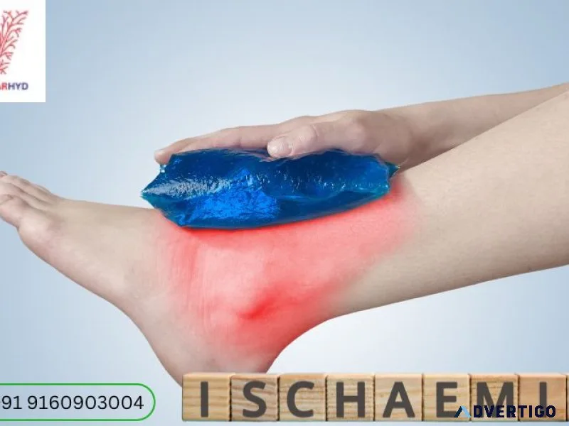 Acute limb ischemia treatment in hyderabad | dr rahul agarwal