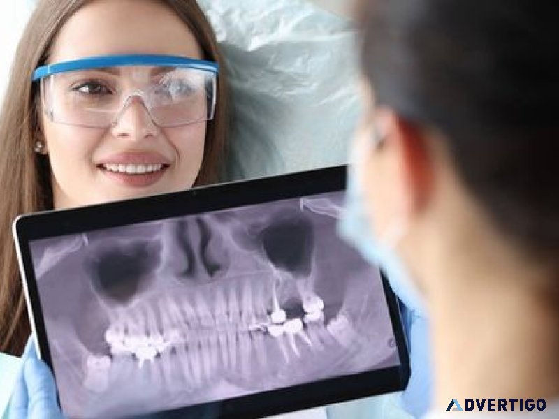 Tooth extraction in abudhabi