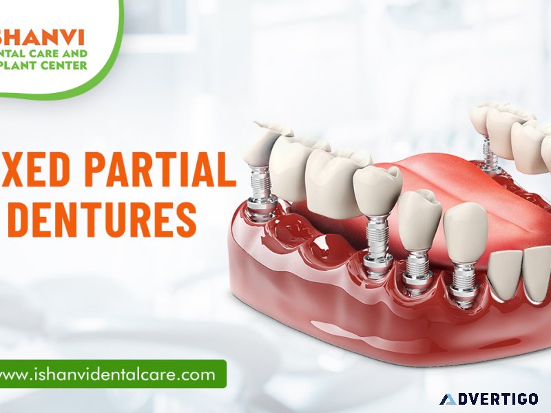 Fixed partial dentures vivekananda nagar