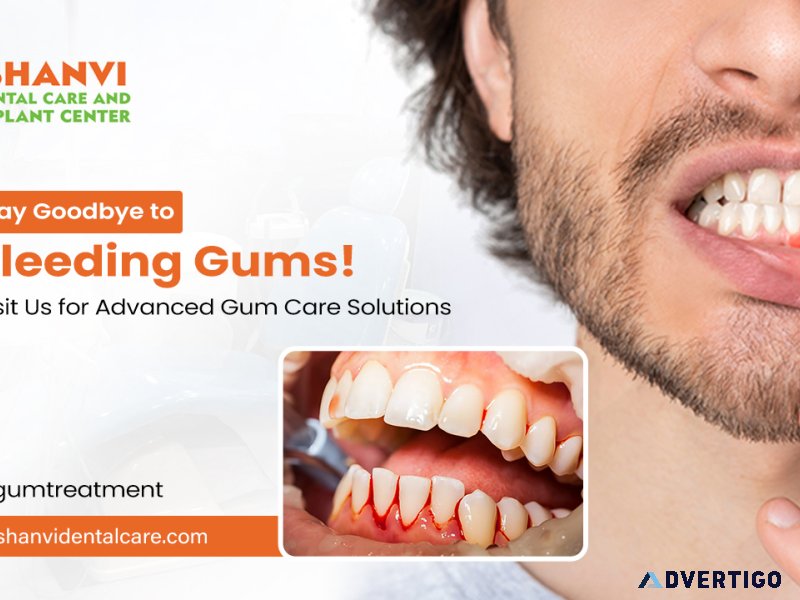 Gums treatment vivekanandanagar