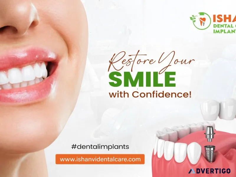Best dental implants vivekananda nagar