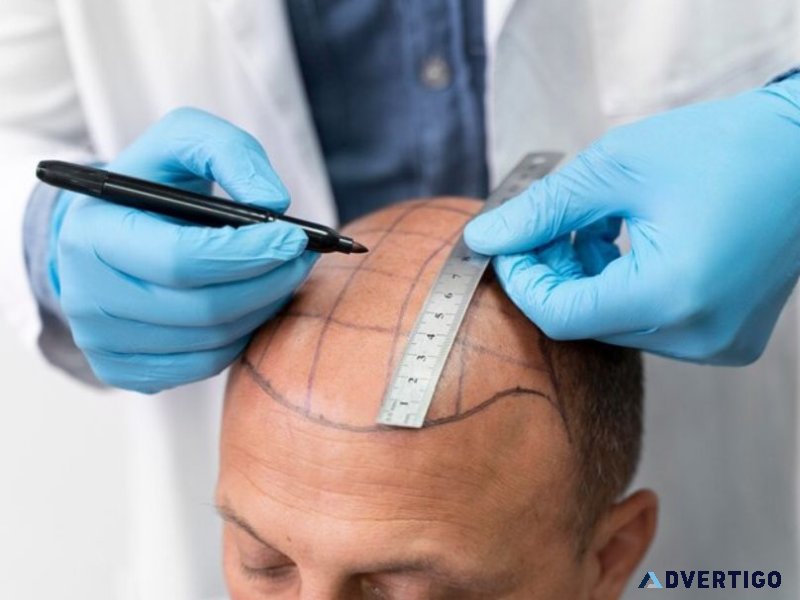 Expert hair specialist in prayagraj for advanced hair treatments