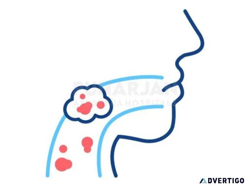 Best oral cancer treatment hospitals in bangalore