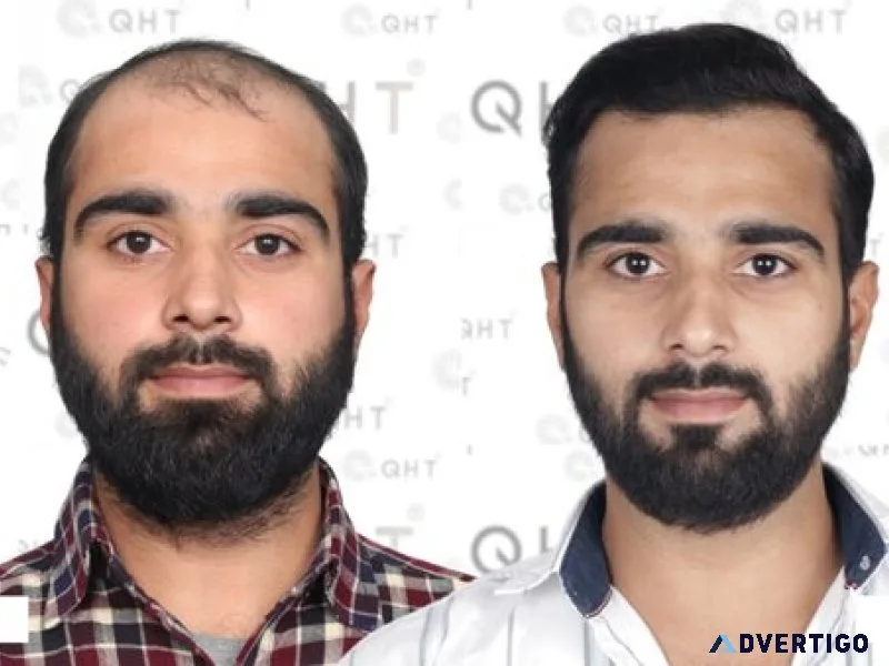 Qht hair transplant clinic hyderabad