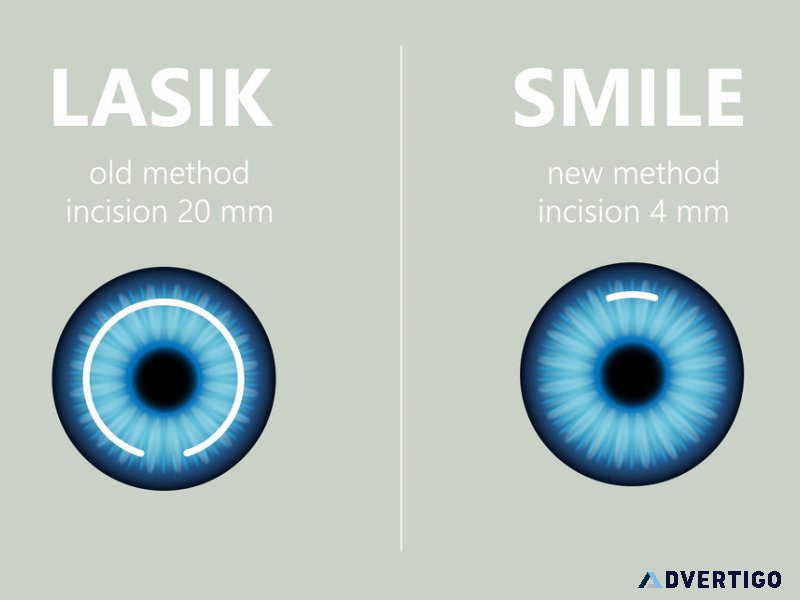 Best eye hospitals in delhi for complete eye care