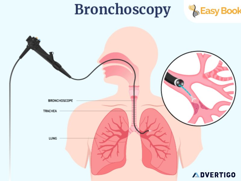 Bronchoscopy test centre in delhi ncr | easy book my lab