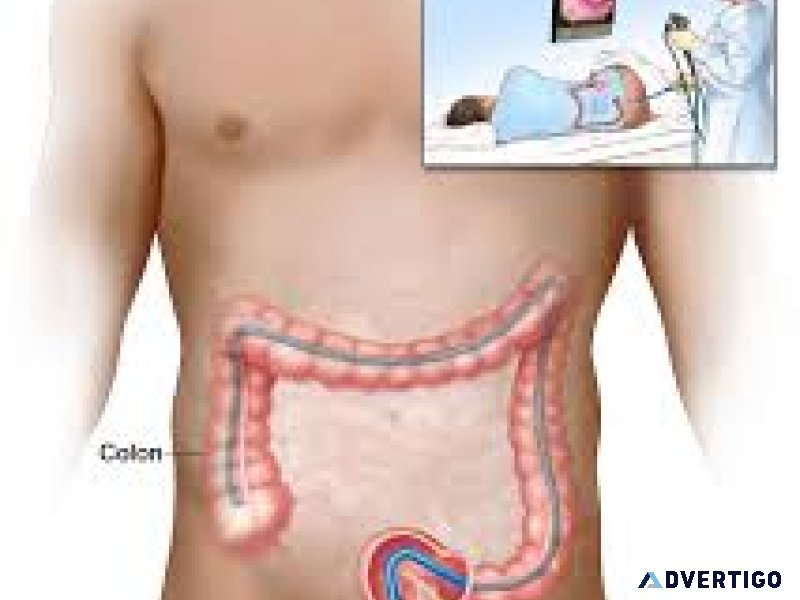 Colonoscopy test center in delhi | easy book my lab