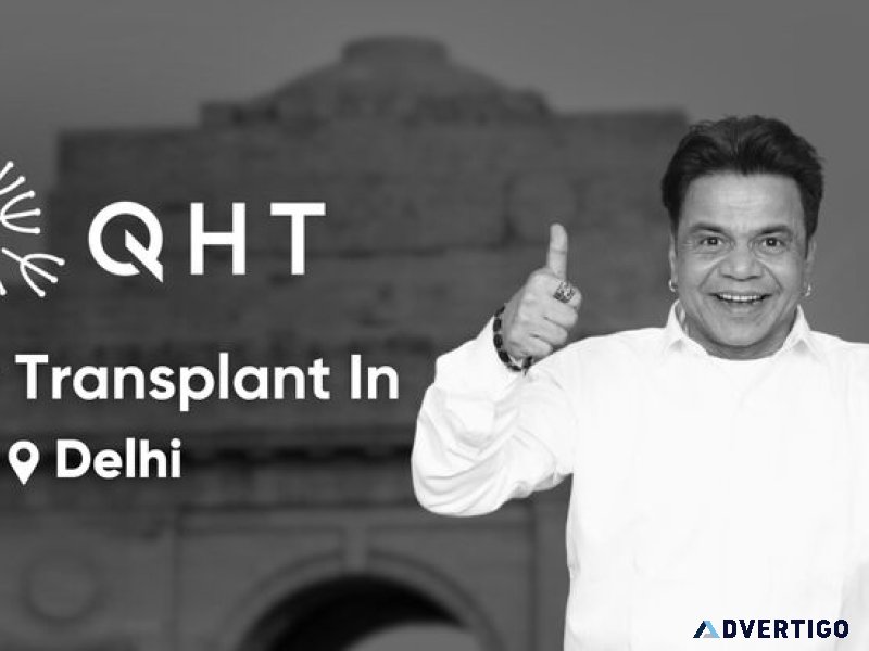 Affordable hair transplant cost in delhi – get natural results